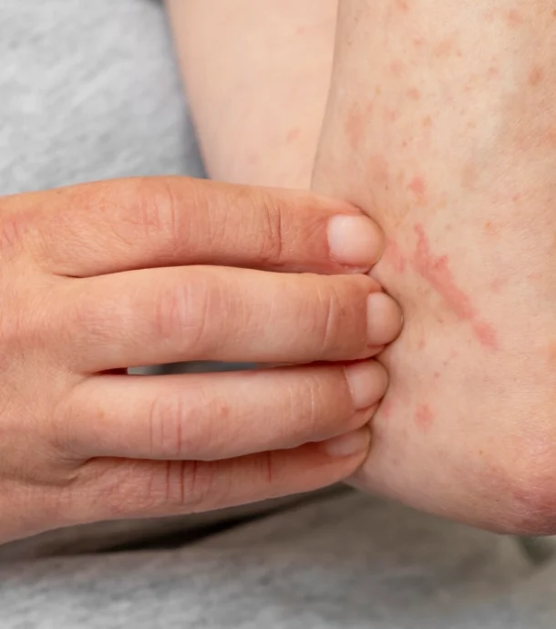 Causes of Minor Rashes Causes of Minor Rashes