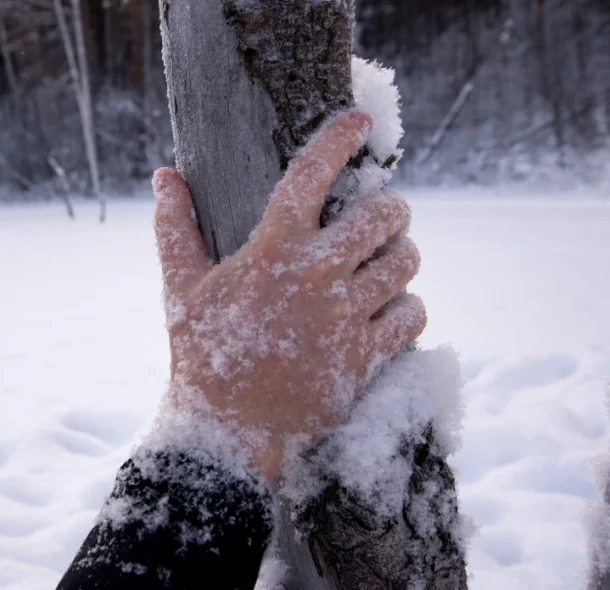 Cold Front_ Frostbite and the Spectrum of Cold-Related Injuries Cold Front_ Frostbite and the Spectrum of Cold-Related Injuries