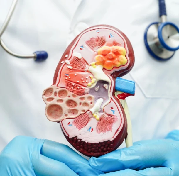 Complications of Untreated Dehydration Complications of Untreated Dehydration