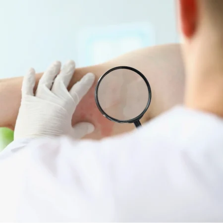 Minor Rash Evaluation 1 Minor Rash Evaluation 1