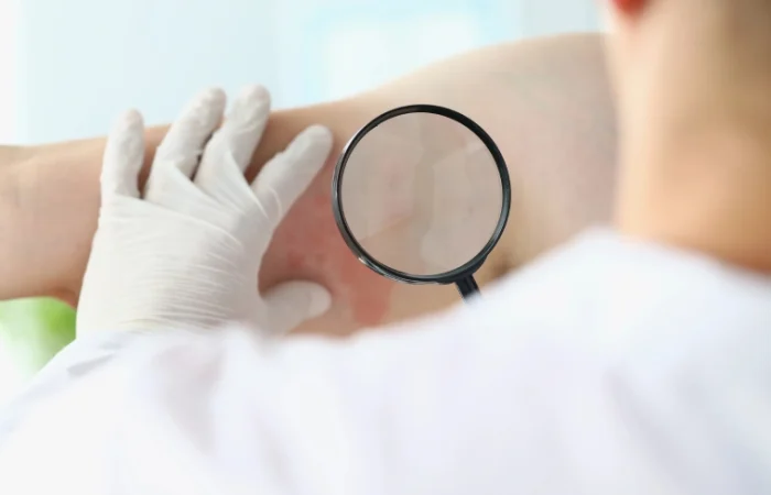 Minor Rash Evaluation 1 Minor Rash Evaluation 1