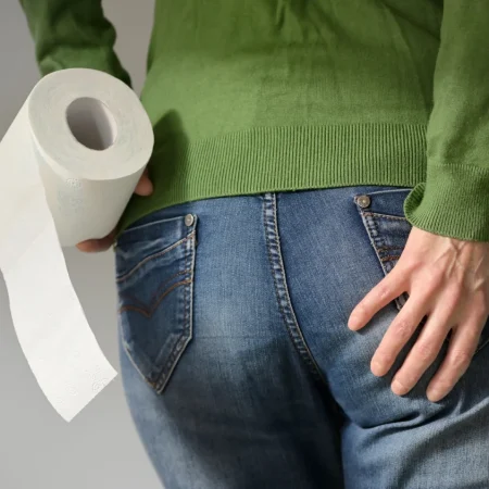 Rectal Bleeding & Hemorrhoids Rectal Bleeding & Hemorrhoids