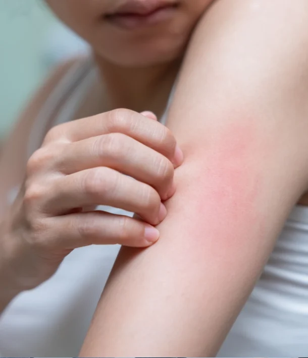 Symptoms of Minor Rashes Symptoms of Minor Rashes