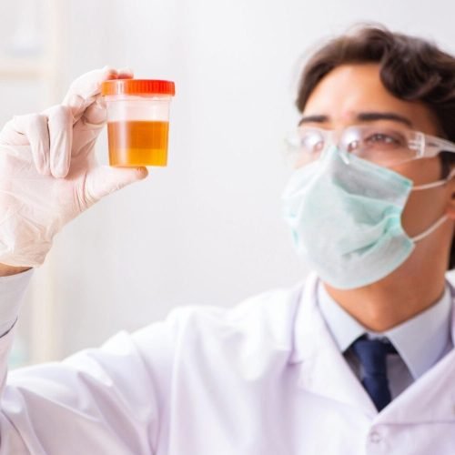 hematuria test hematuria test
