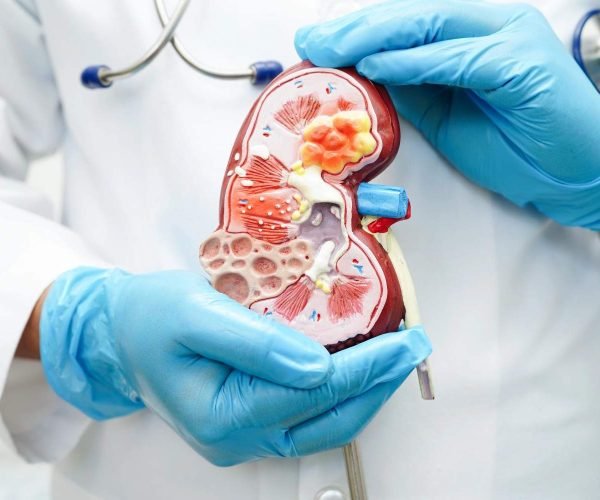 kidney infection kidney infection
