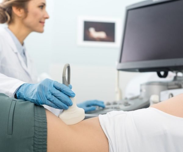 kidney ultrasound kidney ultrasound