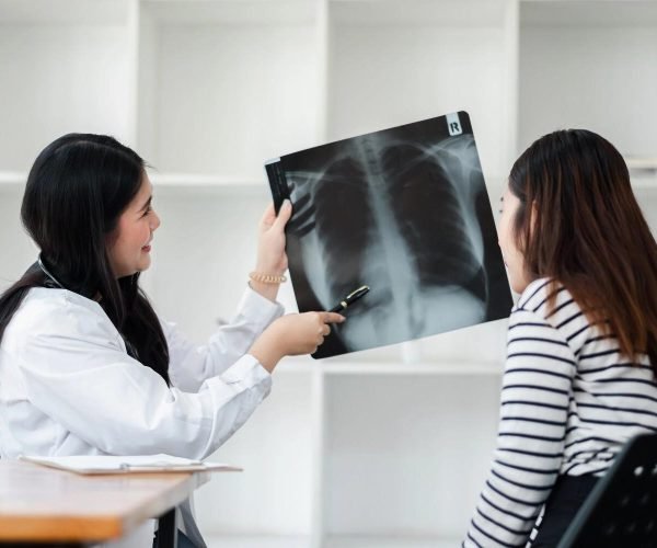 managing mild pneumonia managing mild pneumonia