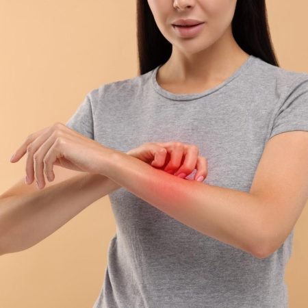 scratchingitchyskin scratchingitchyskin