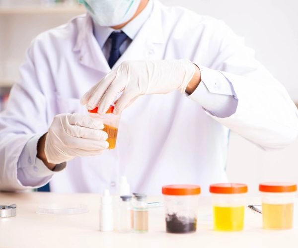 urine lab test urine lab test